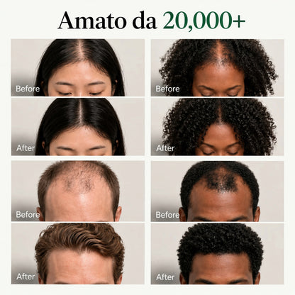 Korean Scalp Revival Bar